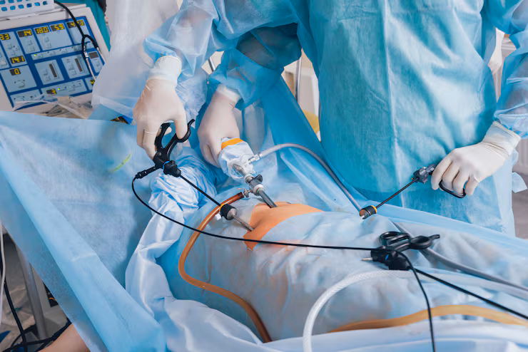 Laparoscopic Surgery